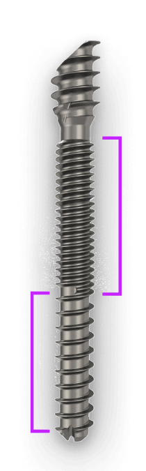 Revcon™ Anchor screw with dual-zone neutral pitch